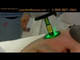 Facial Hair Removal by Laser – 800-867-1941