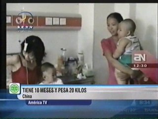 Bebé de 6 meses pesa 20 kilos