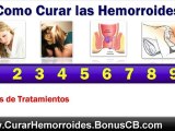 Tratamiento para Hemorroides Externas