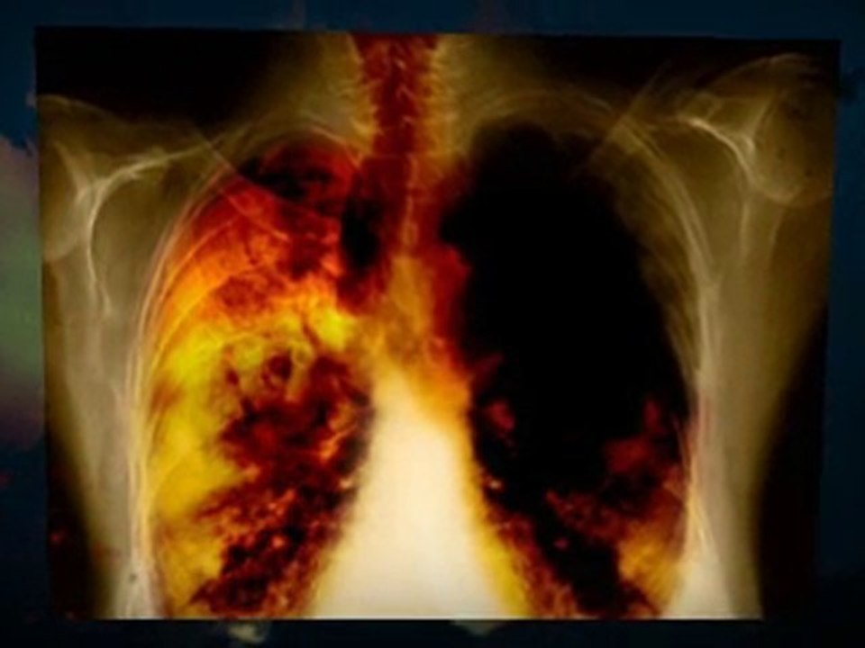 Asbestos Removal Escondido CA 92026