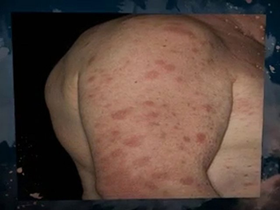 Black Mold Removal Fairfield CA 94533