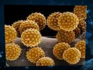 Mold spores Gold River CA 95670