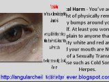 Angular Cheilitis Treatment Free Forever - How to Cure