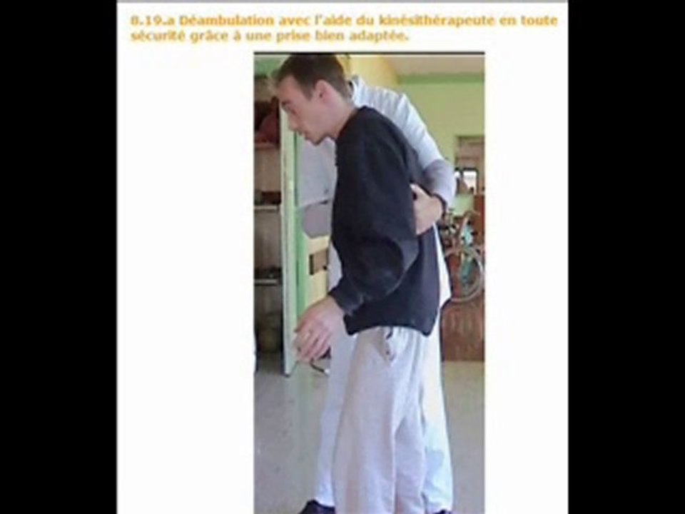 Ataxie et syndromes cérébelleux, présentation du livre