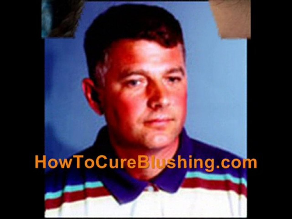 Facial Blushing Cures