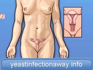 candida bacteria,anti candida diet,candida diet ...