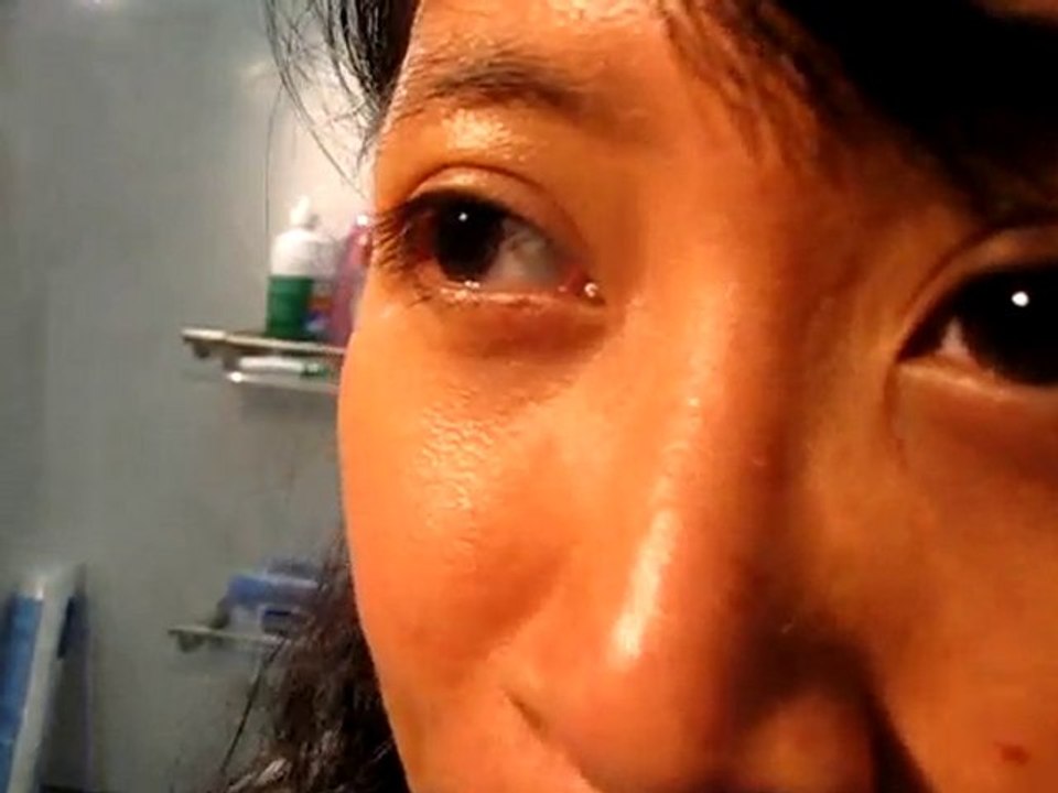 Eye