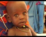 Tchad - Yassine: 9 mois, déplacé et malnutri