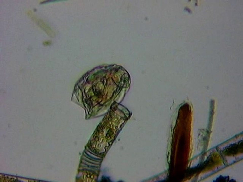 rotifère Lecane x10