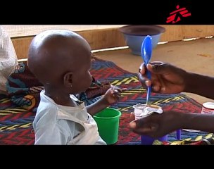 Malnutrition: la révolution des pâtes nutritives