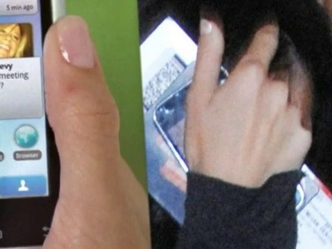 SNTV - Exklusiv: Megans Daumen