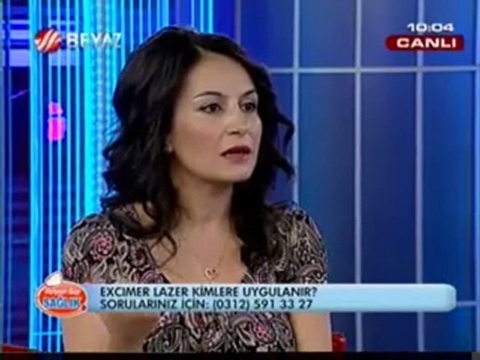 Excimer lazer