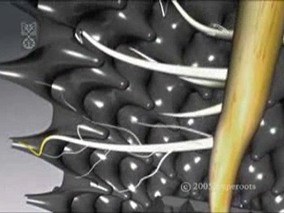 Les nouveaux pots "Air-Pot"