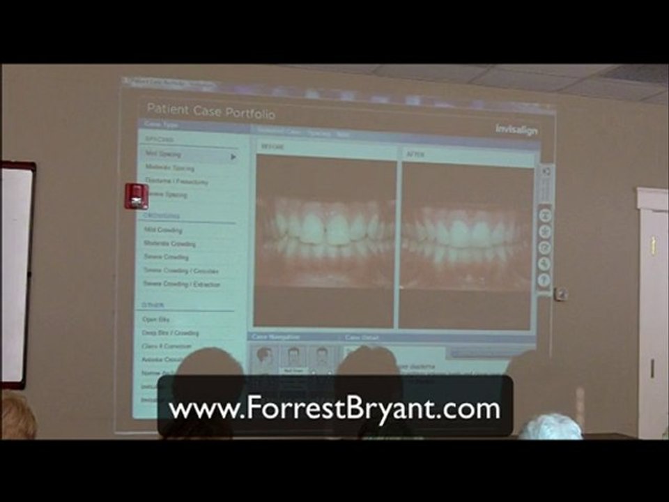 Huntsville Dentist, Invisalign, Teeth Whitening  Video 4
