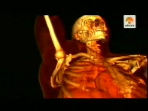 Anatomia: Chimpances y humanos