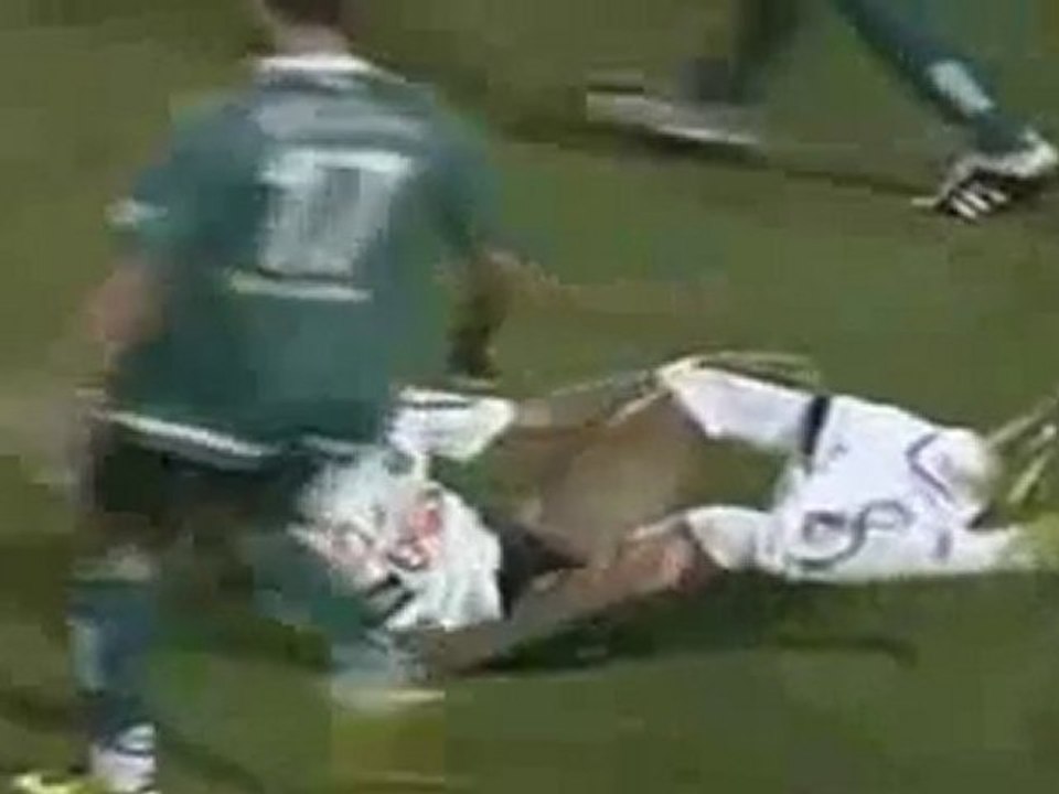 Soccer Player Has a Little Problem