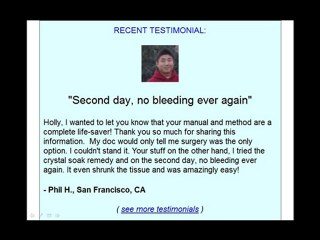 Cures Hemorrhoids Safely in 48 Hours (amazing)