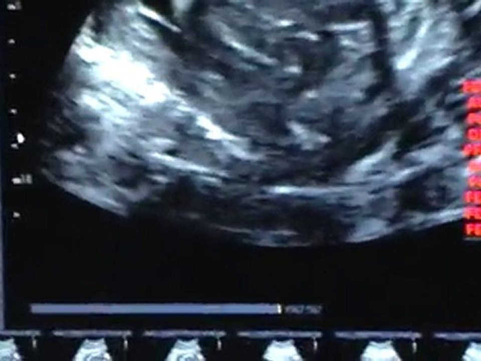 MOV002