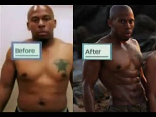 BARRIGA TANQUINHO LIPO ALTA DEFINIÇÃO - LIPOASPIRAÇÃO