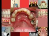 Dentists Adelaide Dr Ian Bills SA