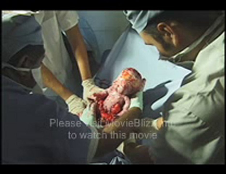 Fetus (2008) Part 1 of 17