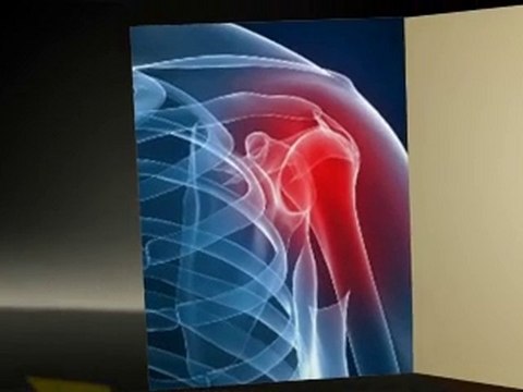 Perth Chiropractor Hillarys