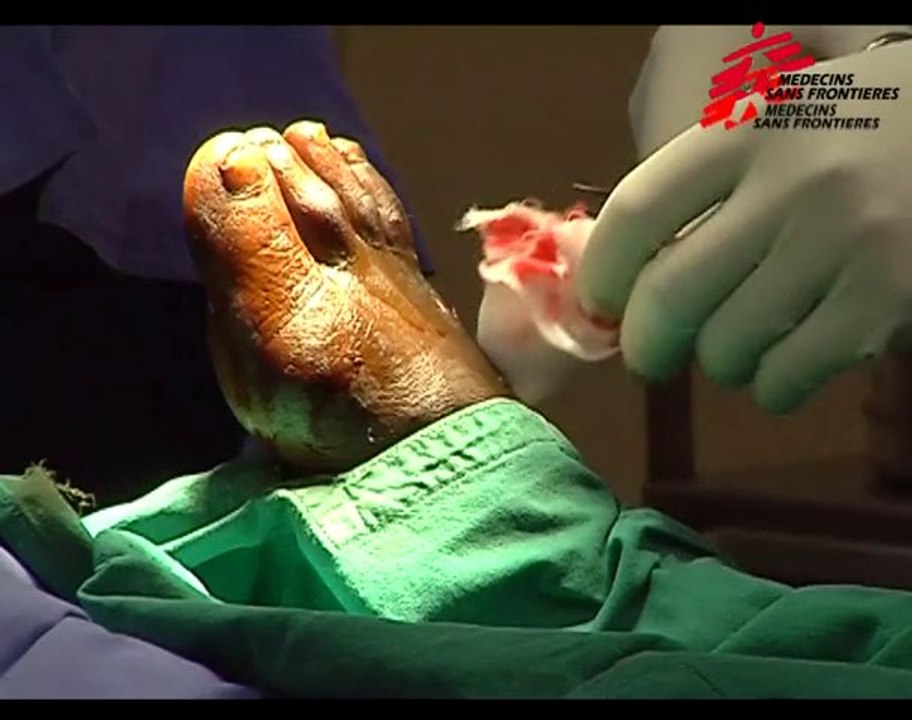 RDC : situation critique au Nord Kivu