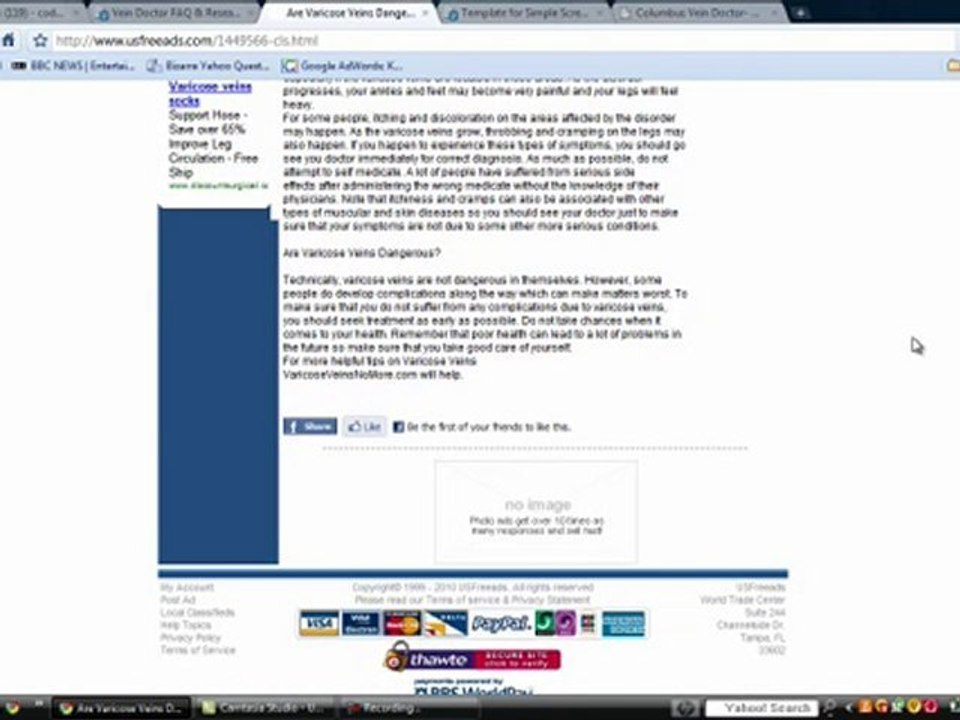 Varicose Vein Doctor Consultations and Information