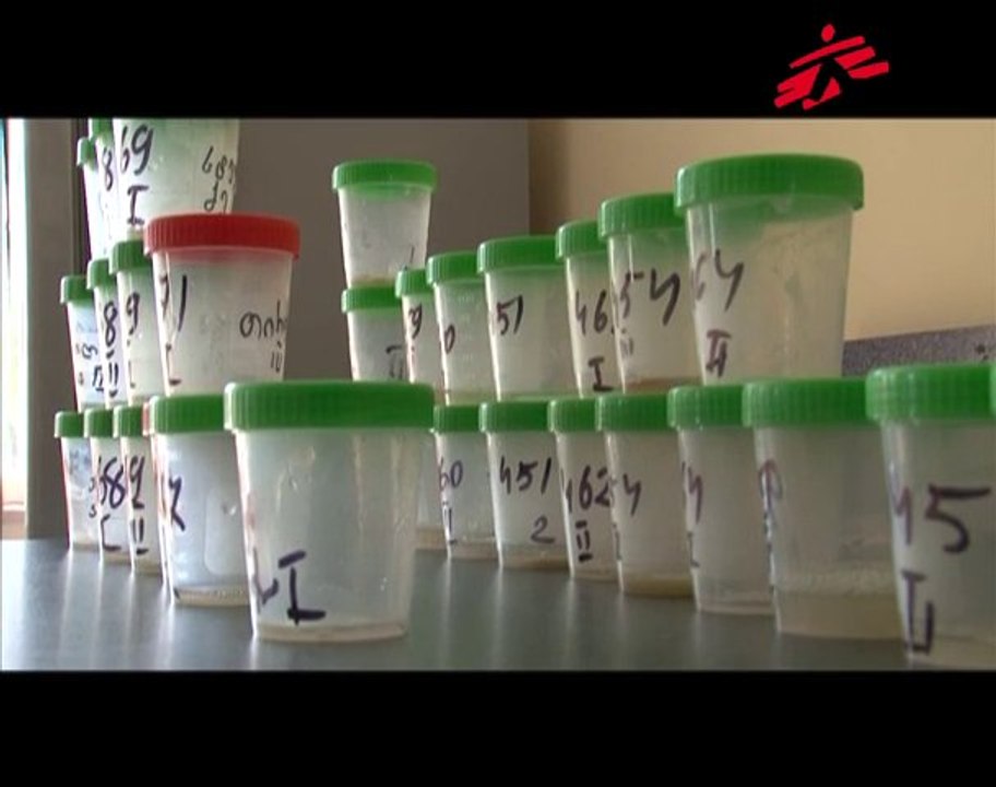 Tuberculose. La résistance gagne du terrain