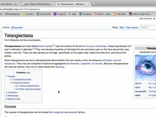 Varicose Vein Doctor Consultations and Information