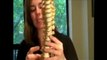 Rockville Chiropractor Scoliosis Spinal Decompression