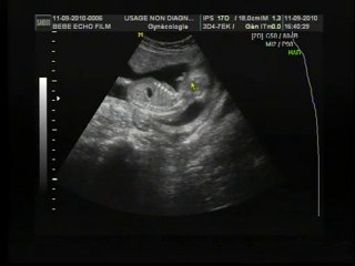 Tite crevette est un homard!!!!