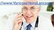 Varicose & Spider Veins in Lancaster, PA Varicose & Spider