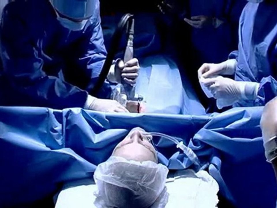 Ablation