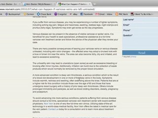 Varicose Vein Doctor Consultations and Information