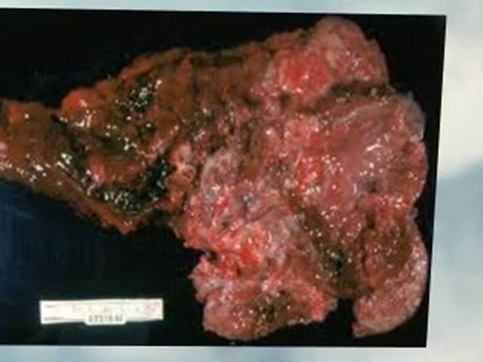 Asbestos Abatement Rhode Island