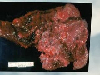 Asbestos Abatement Virginia