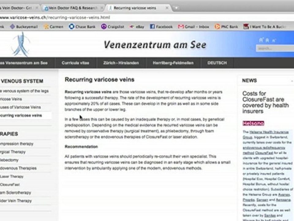 Varicose Vein Doctor Consultations and Information