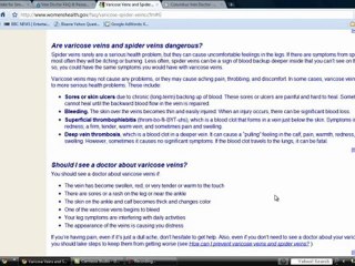 Varicose Vein Doctor Consultations and Information