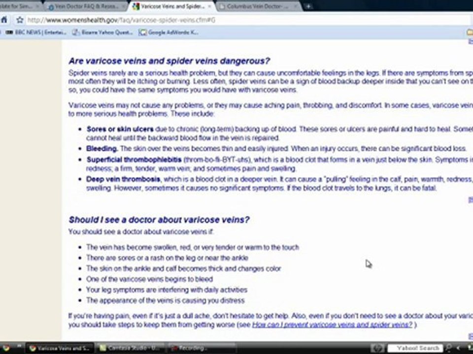 Varicose Vein Doctor Consultations and Information