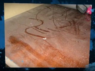 Eczema Rash Treatment Using Eczema Creams