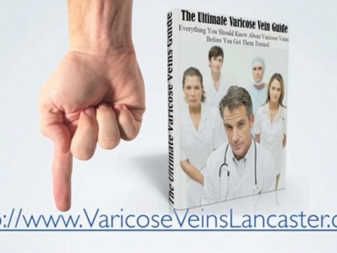 Lancaster PA Varicose Vein Removal Treatment, Varicose Sur