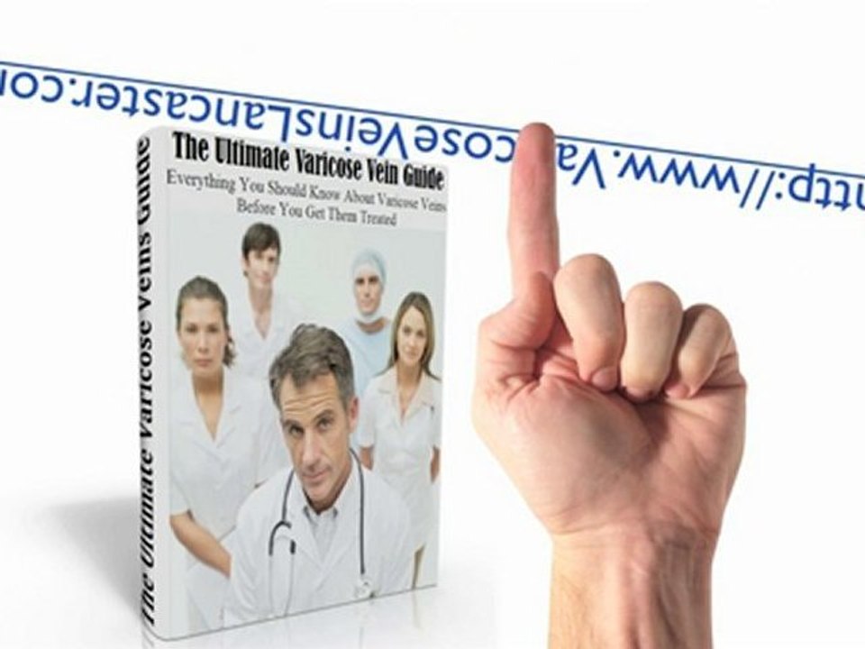 Find Varicose & Spider Vein Removal Treatments in Lancaster