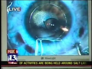 Free LASIK Surgery on Mother’s Day - Eye Institute of Utah