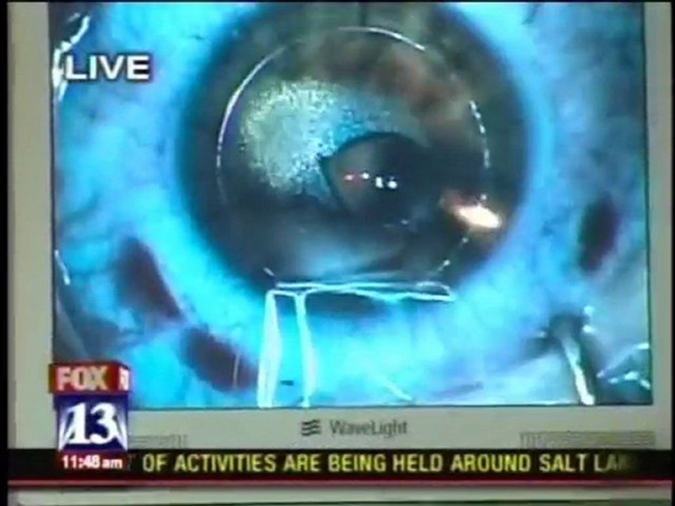 Free LASIK Surgery on Mother’s Day - Eye Institute of Utah