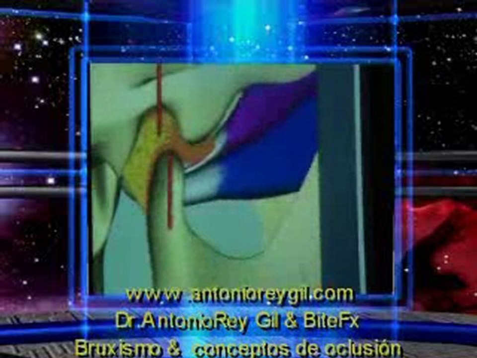 3-Oclusión Función ,Disfunción,Bruxismo.DrAntonio Rey Gil