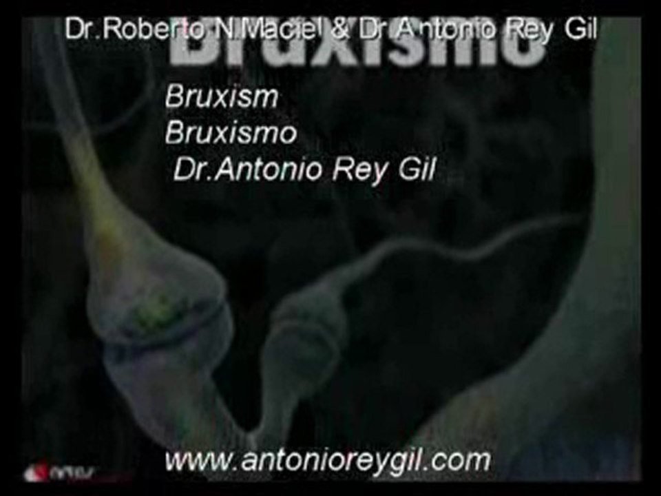 Bruxismo Tratamiento Oclusión  Formación