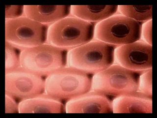 How SizeGenetics Work ?