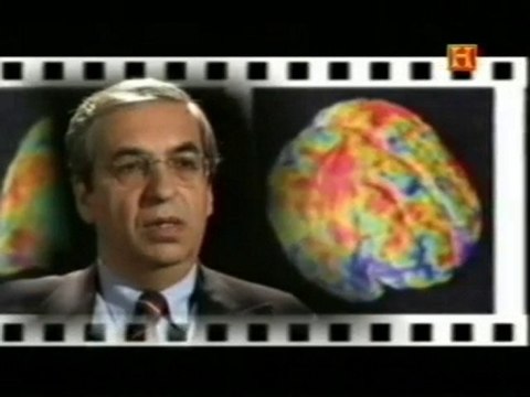 Egas Moniz: La angiografia