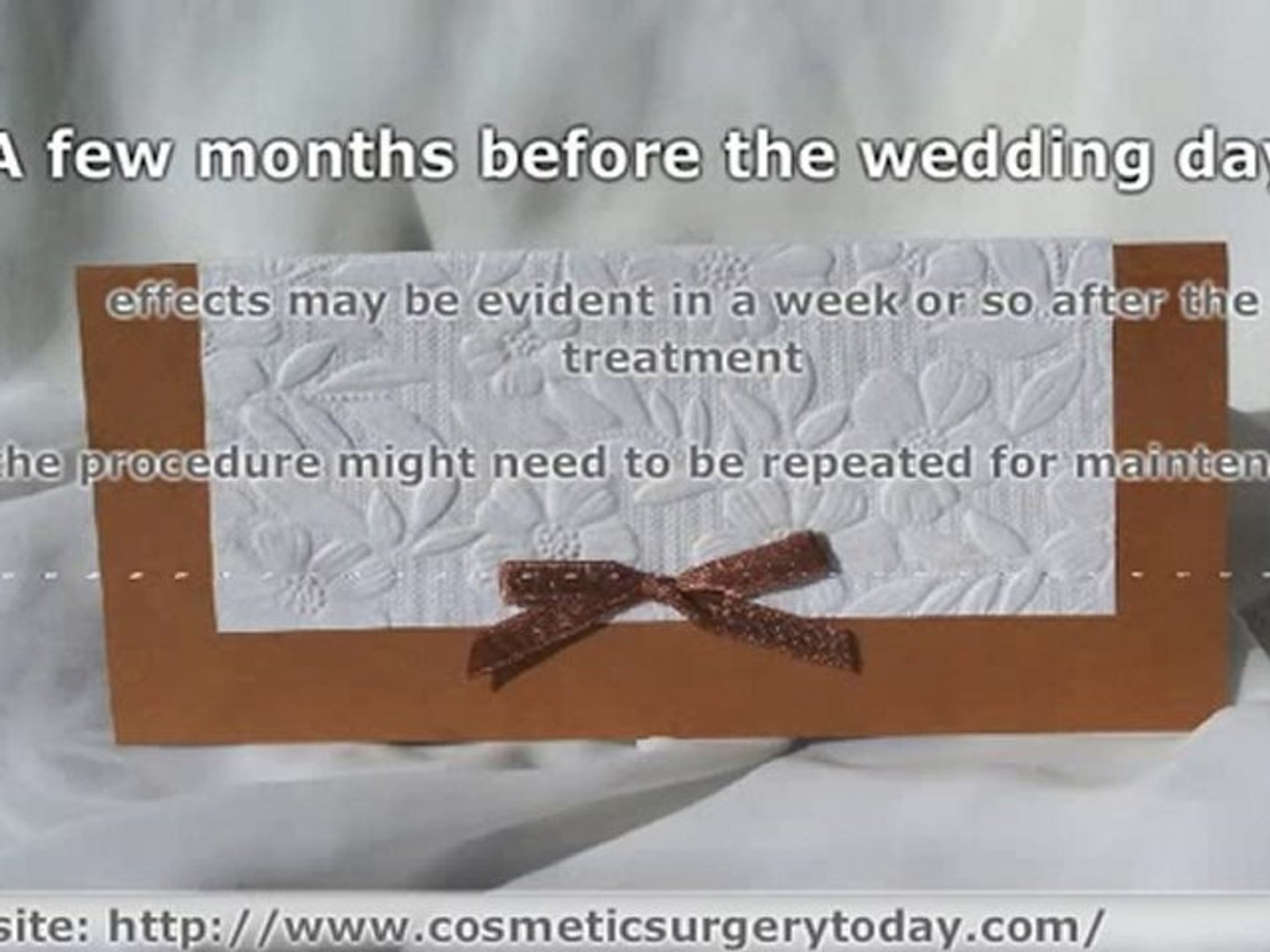 ⁣Extreme Makeover : Weddings